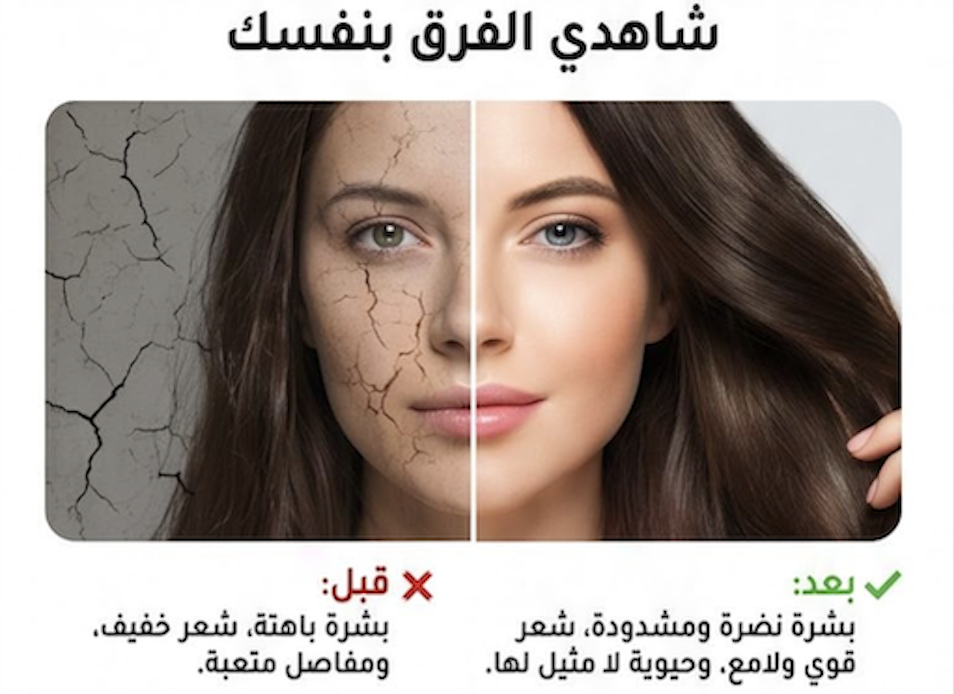 شاهدي الفرق بنفسك — قبل وبعد استعمال فيلوريا